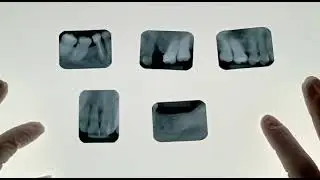 Montagem de cartelas : anatomia por Prof. Andrea Pavanello