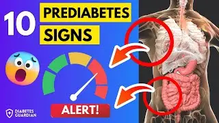 10 Prediabetes Signs You MUST Know Before It's Too Late!