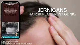 Jernigans Hair Replacement Clinic Ad