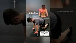 Correct your WINGED SCAPULA #scapularwinging #wingingscapula #wingedscapula #scapularstability