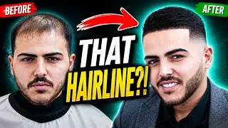 Witness the Magic l Barbers' Transformations Using Hair Powder Fibers