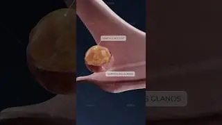 &iquest;Qu&eacute; es un quiste de Bartolino y c&oacute;mo afecta la salud de la mujer? &iexcl;Ginecolog&iacute;a en 3D con VOKA!