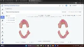 染め出し/プラーク検出モード