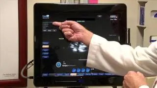 Measuring TGSAV: hTEE by ImaCor