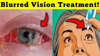 Blurred Vision? These Warning Signs Could Save Your Life!