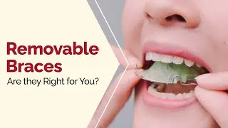 Removable Braces - Are they Right for You?