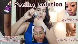 EXFOLIATE Like a Pro with Derma Co Peeling Solution! @thedermacoindia  #video #endlessblossom#review