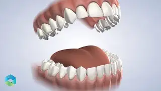 Post-Op: General | Oral Surgery & Dental Implant Specialists South Carolina