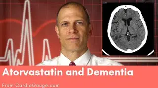 Atorvastatin and Dementia: Do atorvastatin and other statins cause dementia and memory loss?