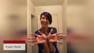 Aortic Dissection Awareness Day 2018 (Part 2)