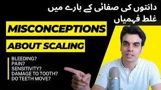 MISCONCEPTIONS ABOUT SCALING/TEETH CLEANING
