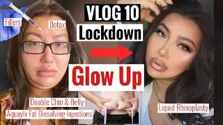 LOCKDOWN GLOW UP | FILLER & FAT DISSOLVING INJECTIONS | EXTREME TRANSFORMATION | VLOG EP10