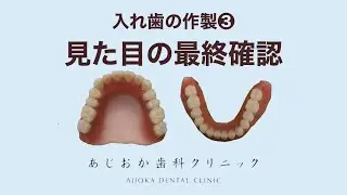 【入れ歯】作製③　見た目の最終確認