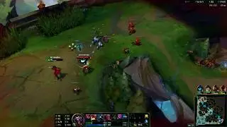 AP SHACO MONTAGE KING BOX' S XD