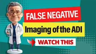 When an MRI and DMX Misses the Diagnosis: False Negative Imaging of the ADI in CCI Patients