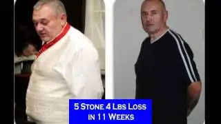 hypnoband hypno band weight loss system uk