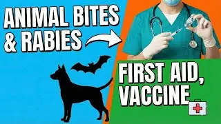Animal Bite & Rabies | First Aid, Vaccine, RIG | Don&rsquo;t Ignore Bites #AnimalBite#Rabies@sehat mantra