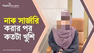 Rhinoplasty patient review | নাক সার্জারি করার পর কতটা খুশি। Nose surgery in Bangladesh | dr Iqbal