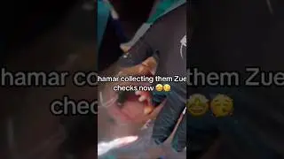 SHAMAR GOT HIS TEETH DONE🥲 #shamar #funny #shamarmcco #zues #zuesnetwork