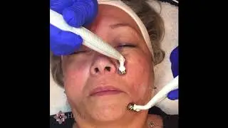 Microcurrent Mini Facial