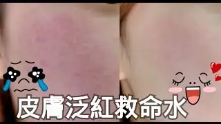 【MyPrincessHK】皮膚泛紅救命水★Nahls Mint Plus Skin Lotion 急救水