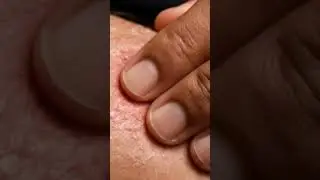 Soft Skin Rubbing & Powder Puff Relief ☁️✋ #relaxing  #asmr #odlysatisfying  #aishorts  #itchyskin