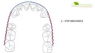 2-Step Mechanics Occlusal - #Orthodontics Animation by @csorthoschool