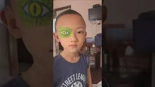 Eye patch for my son for his eyes correction