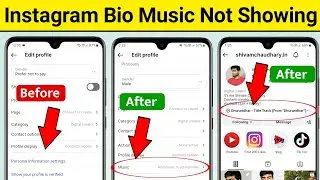 Instagram Bio Music Option Not Showing | Instagram Profile Music Not Showing | Instagram Bio Music