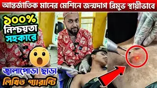 বিদেশি টেকনোলজি দ্বারা জন্মদাগ রিমুভ করুন || Birthmark Removal Laser Treatment in Bangladesh 2025