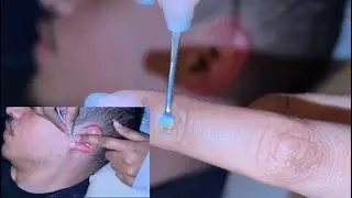 ASMR EAR CLEANING & SOFT GUM CHEWING 😴
