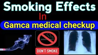 Smoking effects in Gamca medical checkup