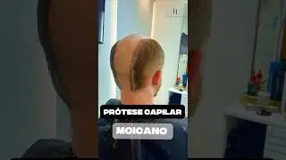 #felipelorenzoprotesecapilar #protesecapilar #hairstyle