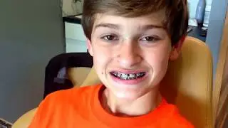 MATTHEW GETTING BRACES- UPDATE #1