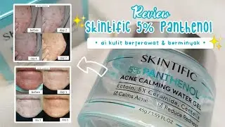 7 DAYS OF USING SKINTIFIC 5% PANTHENOL ACNE CALMING WATER GEL | REVIEW ON ACNE-PRONE & OILY SKIN