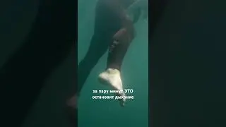 Что делать, если тебя ужалила самая опасная медуза?