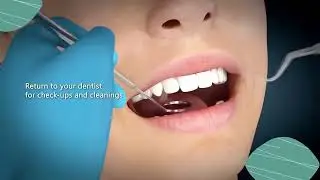 Dental Implants in Dubai, Abu Dhabi & Sharjah - Tooth Implant Cost Dubai