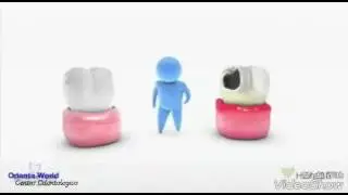 GINGIVITIS  ,PERIODONTITIS Y SU TRATAMIENTO en la clinica ODONTO WORLD