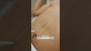 Ultracel Q+