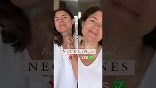 Facial cupping over the neck