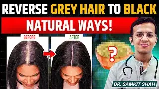How to Reverse Grey Hair Naturally? | Turn White Hair To BLACK Hair Naturally | Dr. Samkit Shah