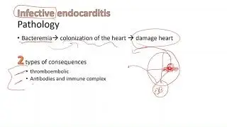 Valvular Heart Disease (Rheumatic Fever & Infective endocarditis) part 2