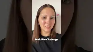 REAL SKIN, NO FILTER #skincare #nofilter #clearskin #skincaretips #nomakeupchallenge #beautytips