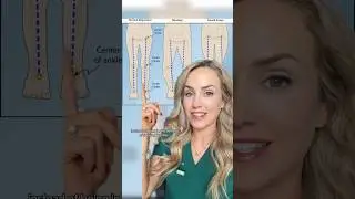 Is your leg bent wrong?