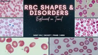 RBC Shapes & Disorders | Explained in Tamil | Medicine | NEET PG | INICET | FMGE | MRB