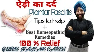 HEEL PAIN | Plantar Fasciitis | ऐड़ी का दर्द जो की ठीक ही नहीं हो रहा | 100 % relief in Homeopathy