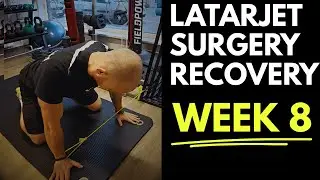 LATARJET SURGERY RECOVERY WEEK 8 | Shoulder Instability, Nerve Damage & MRI