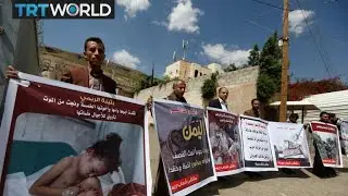 Is the UAE torturing prisoners in Yemen?