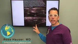 Using ultrasound to diagnose knee pain conditions