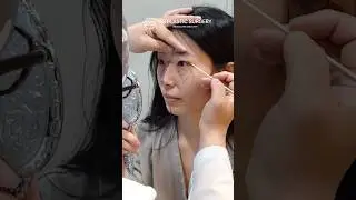 Double Eyelid Surgery Consultation #koreanplasticsurgery